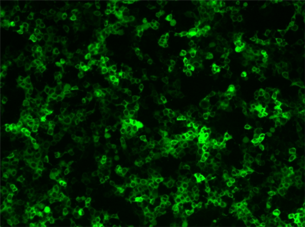 質(zhì)粒轉(zhuǎn)染