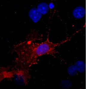 Flag標(biāo)簽抗體