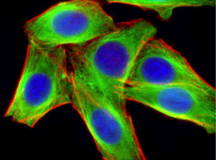 免疫熒光三標(biāo)？&mdash;&mdash;藍(lán)色熒光的AMCA與Dylight 405標(biāo)記二抗