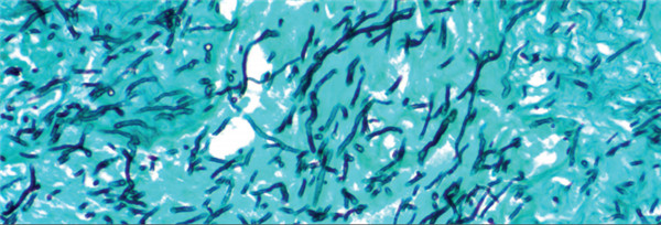 GMS-Stain-Kit.jpg
