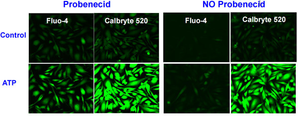 加或者不加丙磺舒（probenecid）對Fluo-4和Calbryte 520熒光標記結(jié)果的影響.jpg