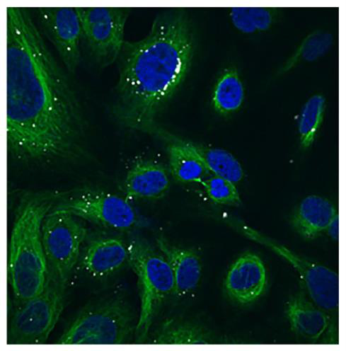 免疫熒光圖.png
