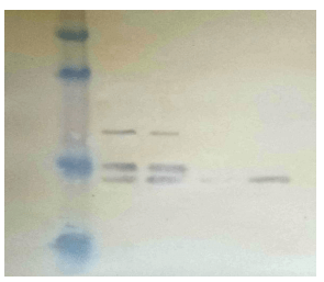 自噬免疫印跡試劑盒（LC3-II 檢測）.png