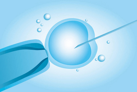 體外受精(In Vitro Fertilization).png