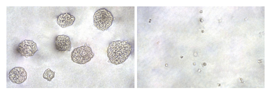 紫杉醇對(duì)HeLa 細(xì)胞錨定非依賴性生長的抑制.png