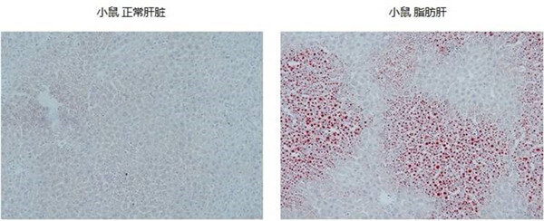 油紅O染色小鼠肝臟結(jié)果.jpg