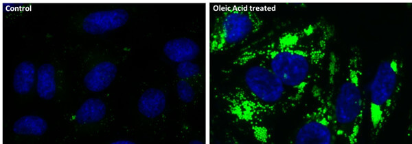 油酸處理的 HeLa 細胞脂滴染色.jpg