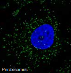 過(guò)氧物酶體.png