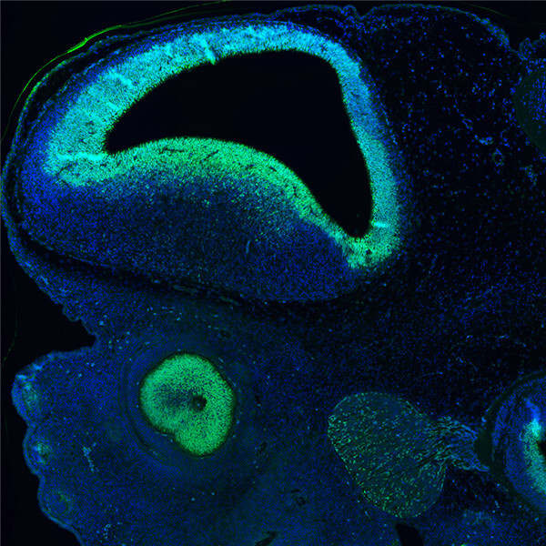 SOX2&nbsp;/ SRY (sex determining region Y)-box 2.jpg