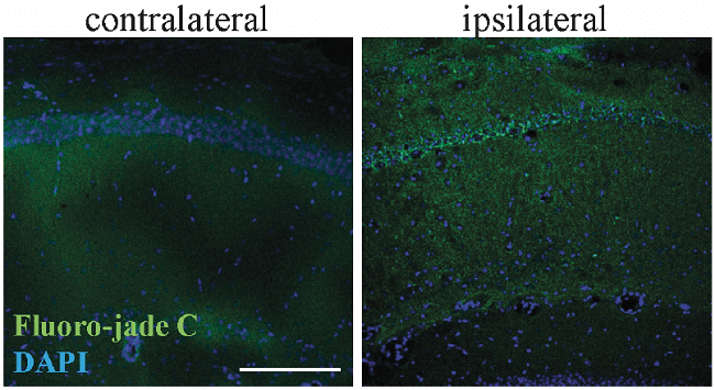 Fluoro-Jade C染色試劑盒Circulation雜志發(fā)表