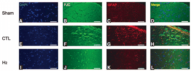 Fluoro-Jade C染色試劑盒Brain雜志發(fā)表