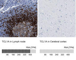 TCL1&nbsp;/ T-cell leukemia/lymphoma 1A.jpg