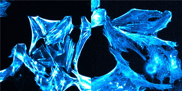 SIR-Actin和SPY650-FastAct?染色對比