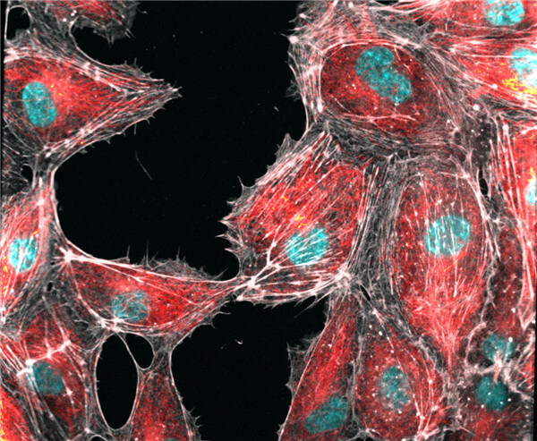 SPY650-FastAct, SPY555-Tubulin和SPY505-DNA共同染色的細胞