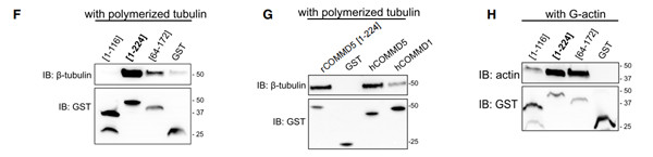 COMMD5/HCaRG 參與組織修復(fù)COMMD5/HCaRG 參與組織修復(fù)