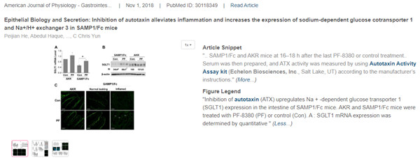 ATX活性檢測試劑盒發(fā)表文獻(xiàn)ATX活性檢測試劑盒發(fā)表文獻(xiàn)