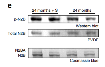 M通用型磷酸化絲氨酸/蘇氨酸抗體