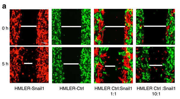 EMT不是癌轉(zhuǎn)移所必需的