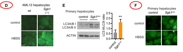 自噬在延長壽命的不同范例中是必需的