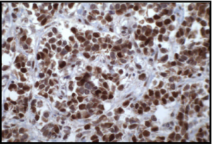 anti-human/mouse&nbsp;Id2 clone 9-2-8