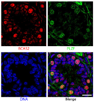 防褪色熒光封片劑