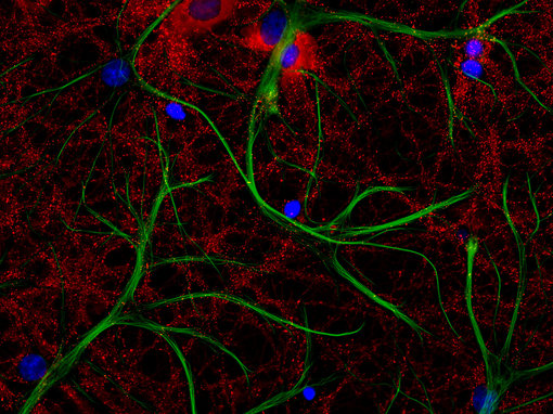 PSD95 FluoTag-X2 抗體免疫組織化學(xué)