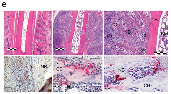 TRAP stain: TRAP染色