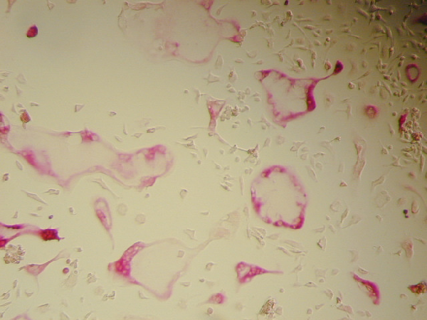 破骨細(xì)胞TRAP染色