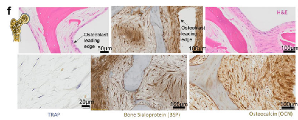 TRAP stain: TRAP染色   