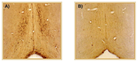 免疫毒素192 IgG SAP