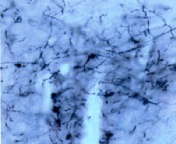 伏隔核注射Fluoro-Gold(熒光金)