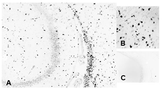Ki-67抗體免疫組化結(jié)果