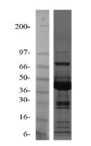 Kif7 電機域純度凝膠