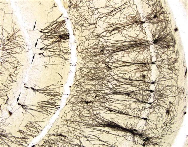 FD RapidGolgiStainTM Kit