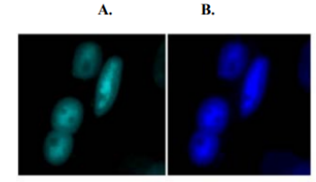 VU‐1免疫染色與PABPN1聚集物在人成肌細(xì)胞中共定位