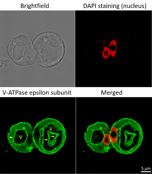 V-ATPase |液泡膜H + ATPase的Epsilon亞基