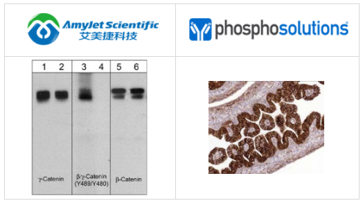 抗β連環(huán)蛋白抗體(M118)