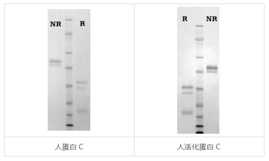 活化蛋白C
