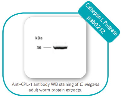 Chromatin IP 染色質(zhì)免疫沉淀 