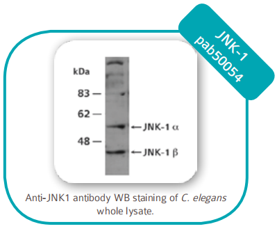 Enzyme-linked immunosorbent assay 酶聯(lián)免疫吸附測定 
