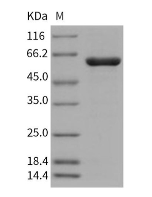 人PTPN2/PTPT重組蛋白