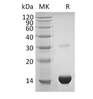 Assay Genie重組人硫氧還蛋白/TXN蛋白(His標簽)(活性)