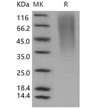 重組人CD164/Endolyn蛋白(His標(biāo)簽)