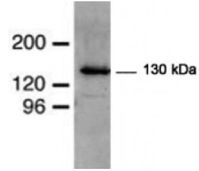 WB-E3泛素蛋白連接酶(MIB)抗體抗mibl抗體WB染色S2細胞裂解物