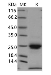 人激肽釋放酶 6/KLK6 重組蛋白 （RPES0275）