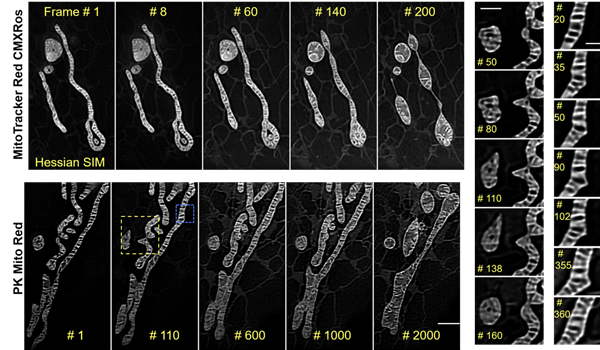 PK Mito Orange(貨號(hào)：PKMDR-1)成像結(jié)果賞析