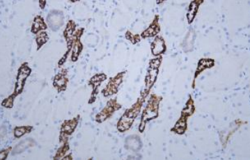 IHCAb KSP-Cadherin鼠單抗(PT0160)