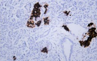 IHCAb Insulin鼠單抗 (PT0156)