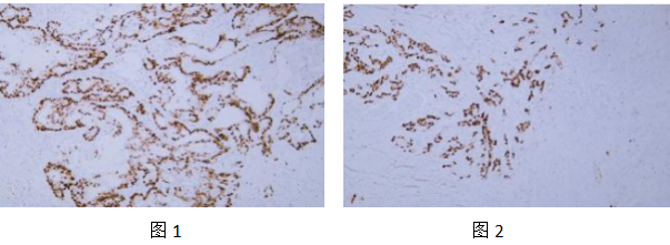IHCAb SOX9 (BGT-SOX9) 鼠單抗