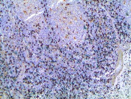 HIGHDEF 黑色 IHC 顯色原 （HRP）